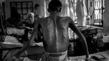 যক্ষ্মায় প্রতিদিন মৃত্যু ১২১ জন