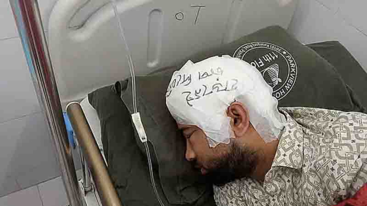 দুই মাস পর মামুনের মাথায় লাগানো হলো ফ্রিজে রাখা মাথার খুলি